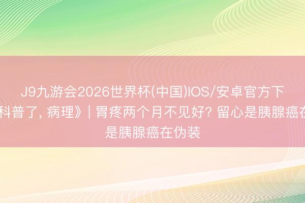 J9九游会2026世界杯(中国)IOS/安卓官方下载 《科普了， 病理》| 胃疼两个月不见好? 留心是胰腺癌在伪装